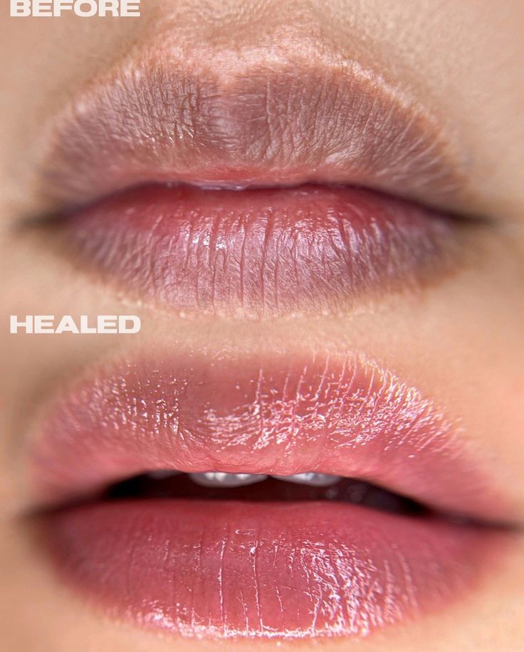 Lip Bright | Lip peel of mask